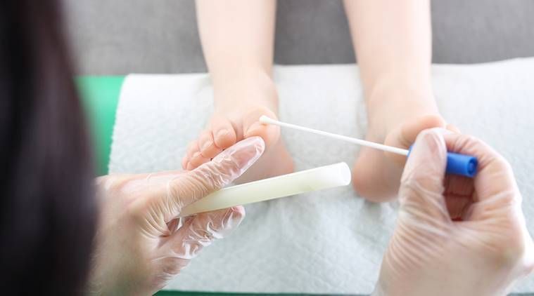 cáncer de cuello uterino, prueba de Papanicolaou